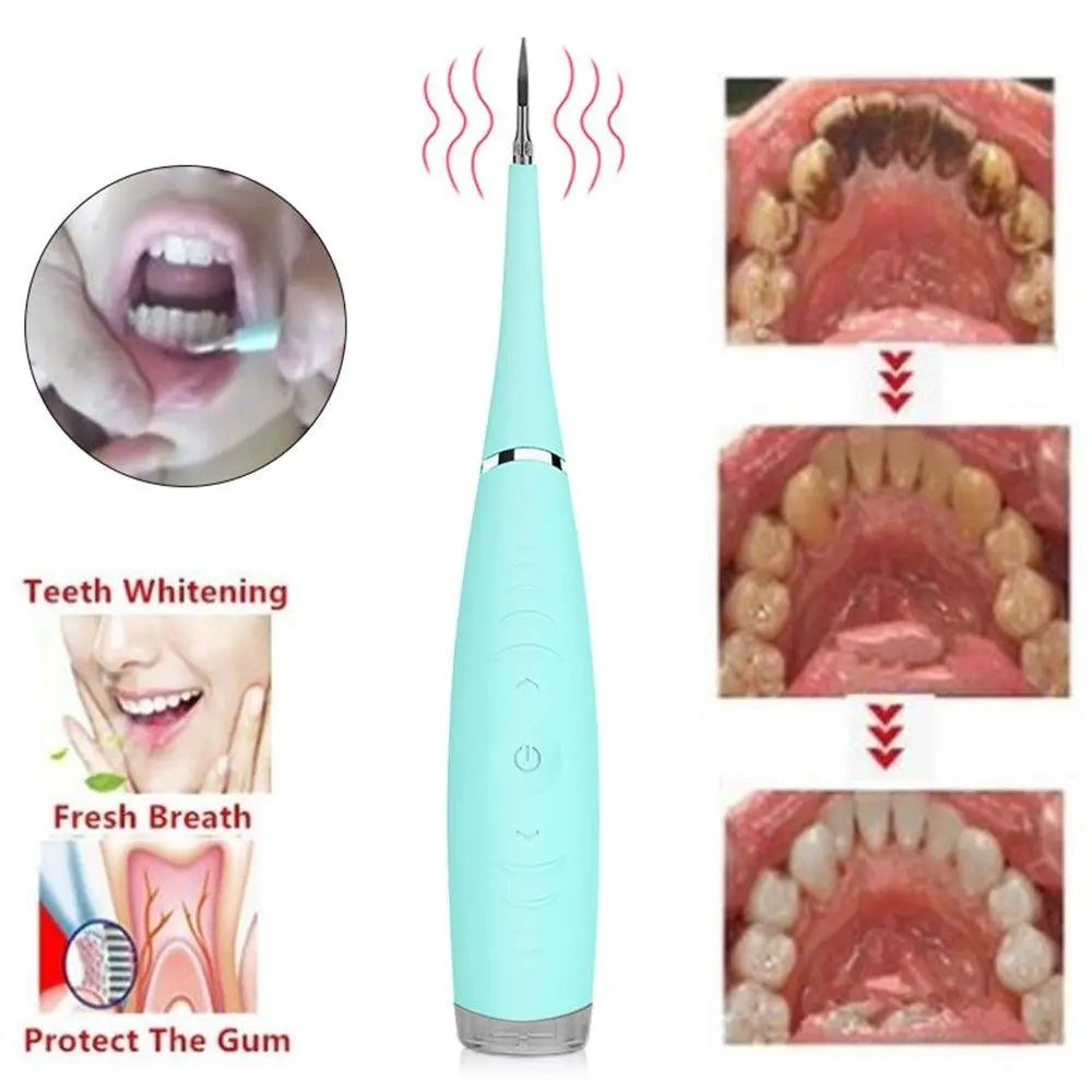 Ultimate Electric Tooth Cleaner for Deep Dental Care